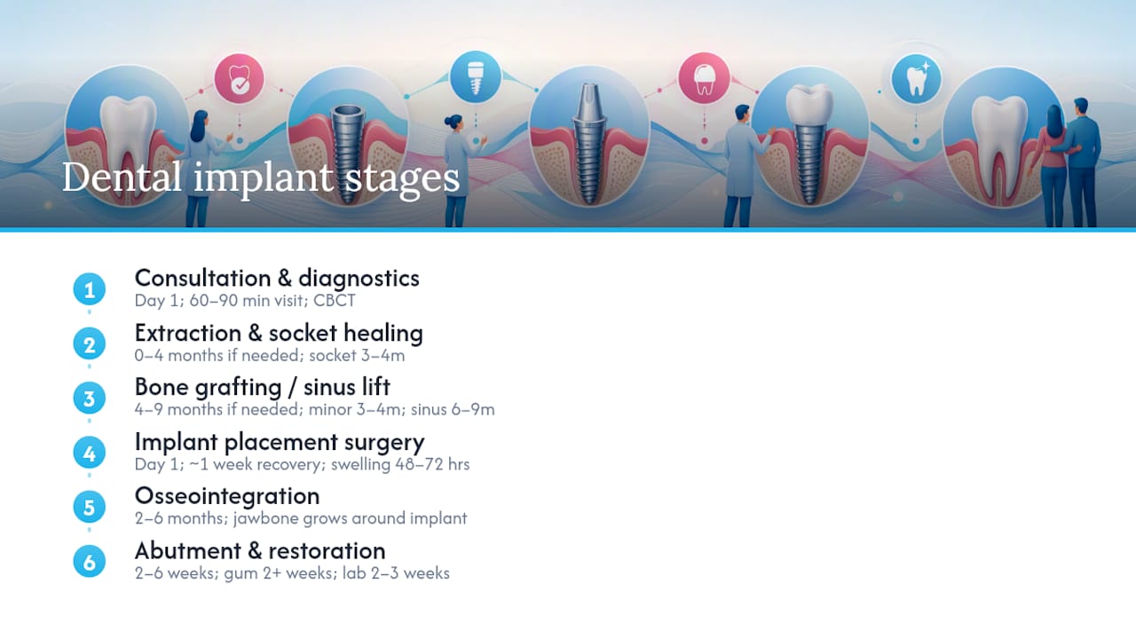 Dental implant timeline stages and durations infographic
