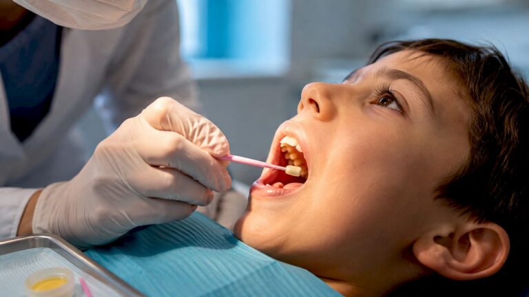43% Less Decay: Fluoride Varnish Benefits Backed by Evidence