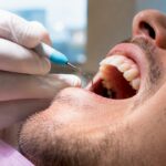 Periodontist measuring gum pocket depth